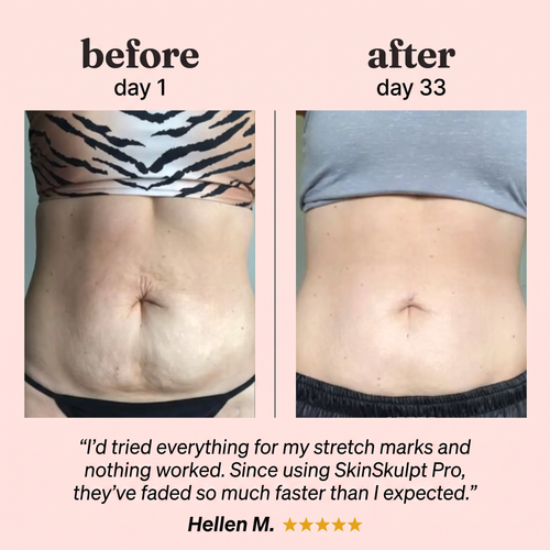 SkinSkulpt Pro™